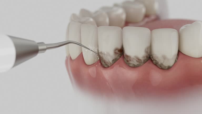 Trusted Dental Crowns And Bridges service in Kinnelon, NJ - Dentist Open Now